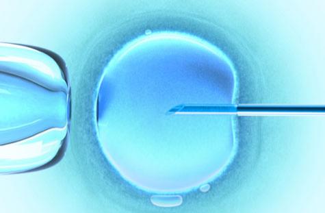 ivf-pic