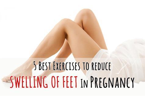 5-exercises-to-reduce-swelling-of-feet-pregnancy  large